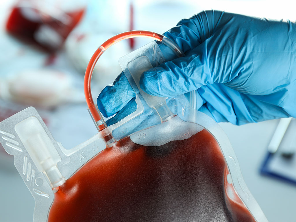 Modernização para Transfusões Seguras e Eficientes